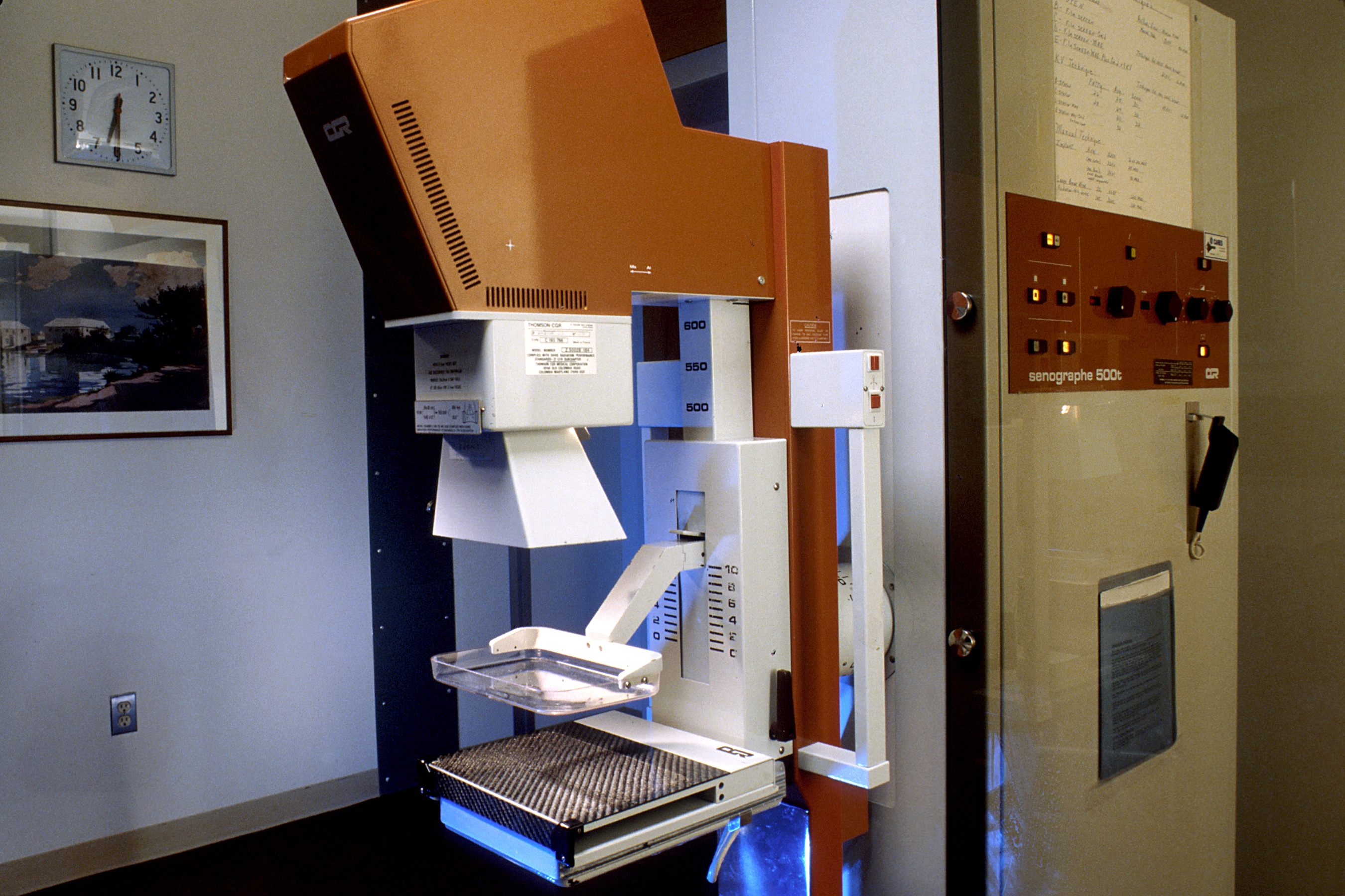 Routine Mammograms with AI Detect Hypertension, Heart Disease and Stroke Risk