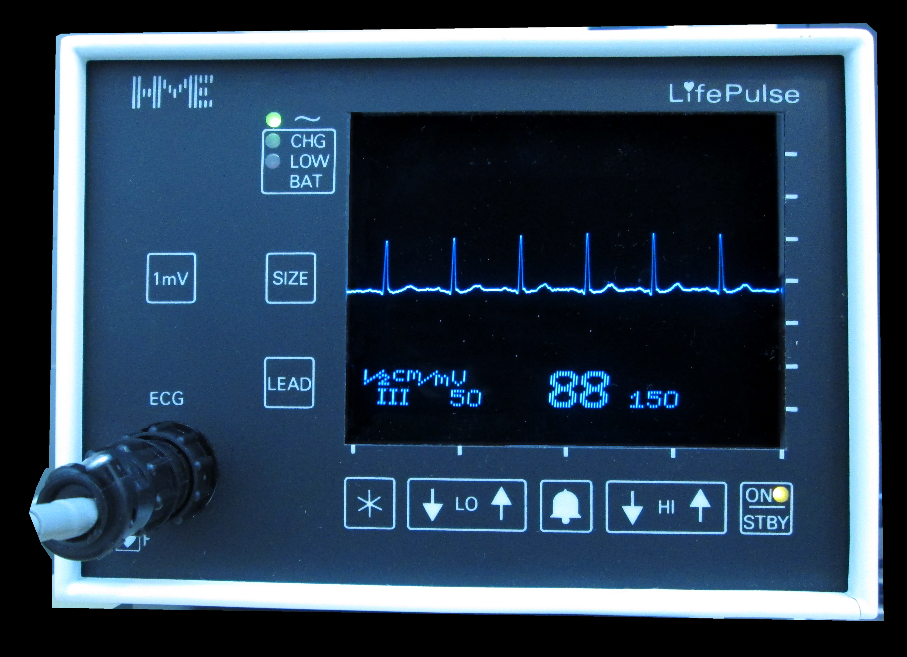 Model AI ECG-CLIP wykrywa choroby serca na podstawie kilkunastu przykładów EKG